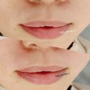 서상동110 | [창원왁싱] 서상동 유니시티앞 창원금손언니왁싱으로 인중왁싱하러오세요😉❣️