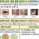 유전성 척수 소뇌실조증의 분류와 예후!! - 글루탐산 흥분성 독소 치료 한약탐구!! 이미지