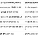 게의 진균 Trichomaris invadens 감염 흑매트 증후군(Black Mat Syndrome, BMS) 대게(Snow cra 이미지