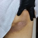 계산동피부관리 아토피 피부 장벽 강화 바쿠나 관리 3회차 후기 리쥬블룸