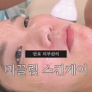 미끌림 - 목포시 | 반포 피부관리미끌림 스킨케어에서 여드름 관리 받고 온 후기