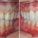 바른이 치과기공소 이미지