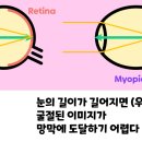 마이오 이미지