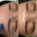 靑春-아름다운 나날 | 부산눈썹문신 제거 잔흔커버, 미모 성수기 무보정원본