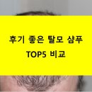 후기 좋은 탈모 샴푸 TOP5 비교, 내게 맞는 제품은?