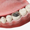 일산스마트치과의원 이미지