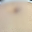압구정함춘산부인과의원 네이버블로그