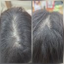 헤어클리닉 | 청주산남동미용실 붐헤어 클리닉 후기