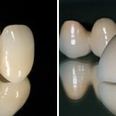 판치과기공소 이미지