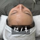 UR(화성시)-대(집)3-3[상리3길]-상-6 | 봉담피부관리 아티스트비에스 봉담점 에스테틱 스킨플래닝 노보정