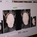 뉴에이징의원 | 길음뉴타운피부과, 울쎄라피프라임 vs 써마지 vs 티타늄리프팅 선택 가이드