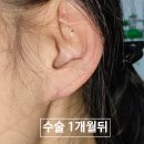 강동실비 이미지