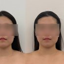 새로피다 | 청주 율량동 피부관리 피다에스테틱 윤곽관리 후기