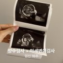 양수로 | 양수검사, 미세변이검사 후기 (임신16주)
