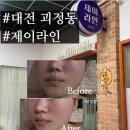 대전 윤곽관리 맛집 찾는다면? 괴정동 EMS 윤곽관리 제이라인 솔직후기