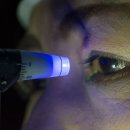 녹내장 및 녹내장 치료에 대해 알아야 할 모든 것 이미지