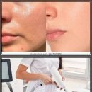 잠실예쁨주의쁨의원 | 피부 건강 지키는 꿀팁 아보카도 팩, 햇빛, pH 밸런스!