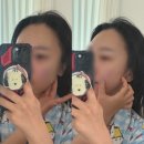 한불피부관리실 봉곡점 | 구미 봉곡동 문스 뷰티플러스 3D 윤곽 관리 얼굴 윤곽 살리기, 로얄 5케어 후기