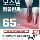 미금세브란스치과의원 | 캐시닥 링크공유퀴즈 정답_미금세브란스치과의원 미금세브란스치과 오스템 임플란트 이벤트