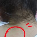 율하엘의원 | 아기 피부 고민.... 장유 율하 엘피부과에서 상담받쟈