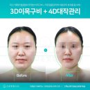 고운손길피부관리 | 대구 피부관리 추천 고운빛깔에스테틱 대구점에서 받은 피부관리 솔직 후기와 만족한 이유