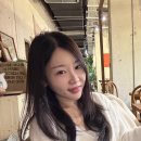 해사람 | 세르프 300샷 한달 후기, 써마지 해본 사람이 느낀 중안부 변화