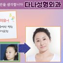 김헤어라인 이미지