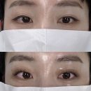 불당동 속눈썹 연장 하라뷰티 후기 천안 속눈썹연장 속눈썹펌 잘하는곳 추천