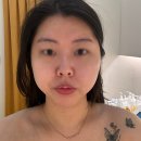 광교에스테틱 퓨어림 쫀쫀탱탱한 H리프팅 후기