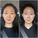 결이고은 일산점 경락 3회 후기 얼굴이 진짜 작아졌지 모에요?