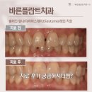 서울바른정치과의원 이미지