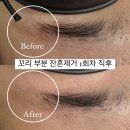 유화헤어라인