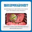 1급 위암 유발인자 헬리코박터 이미지