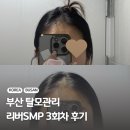 학동중심사입구역 1번출구 엘리베이터정면 | 부산탈모관리 리버SMP 가르마 두피문신 3회차 비포애프터 후기