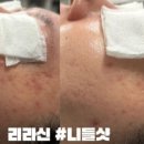 영바디샵