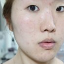 잎순코스메틱 | 여드름 진정에 뛰어난 피부 진정토너, 피부 진정크림!