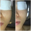 [서윤피부맑음 서현점] 분당피부관리, 서현역피부관리, 서현피부관리, 야탑피부관리, 올해의 관리, 최고...