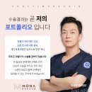 1731 | 33세 여자 헤어라인 비절개모발이식 1731모낭 7개월차 수술후기