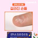 채널독 | 쌓이면 독이 되는 장 독소 늘 다이어트 실패한다면...A 화요일 건강 예능 &lt;몸신의 탄생&gt; 25회 시청 후기