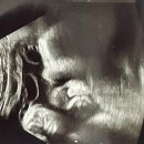 광안3-202 | 광안자모병원 36주/37주 진료후기 태동검사비용