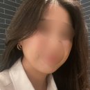 울산 쥬베룩볼륨으로 땅콩형 얼굴 개선 후기 중안부 축소효과