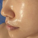 일동제약(주) 안성공장 | ​[안성피부관리] 수화강리셋핏 &amp; 수화강테라피로 예민피부 윤곽관리, 피부고민 해결책