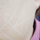 리프트성형외과의원 | [인계동 병원] 수원 실리프팅 잘하는곳 추천 필리프트 성형외과