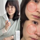에스트라 아토베리어365 크림 민감피부를 위한 올리브영 1등 보습크림 추천