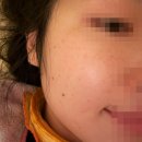 2571 | 2571. 서면 리쥬란 힐러, 쥬베록 스킨 후기