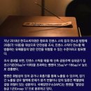 &#39;인센스 스틱&#39; 방에서 6년 동안 태우다가 폐암 걸린 여성 이미지