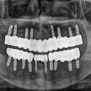 블루치과기공소 이미지