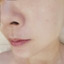 911 | 수원 피부관리 잘하는 곳｜리프팅 직후 즉각 효과 본 글루밍에스테틱 후기