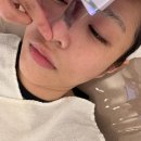 모모미나 | 알로하 에스테틱 내돈내산 후기: 3n년차 트러블러의 저자극 압출 성공기