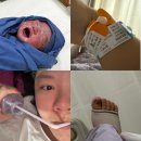제일전자 | 분당제일여성병원 임신중독증 전자간증 응급 제왕절개 후기 (1일차)
